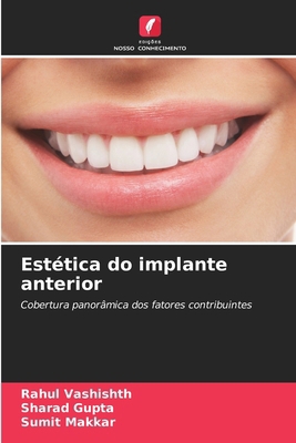 Estética do implante anterior [Portuguese] 6208917115 Book Cover