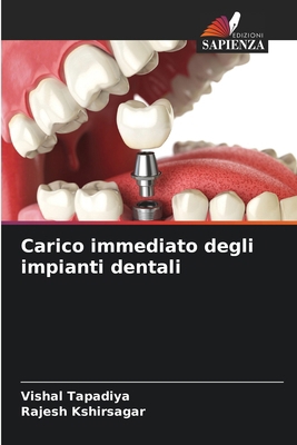 Carico immediato degli impianti dentali [Italian] 620766079X Book Cover