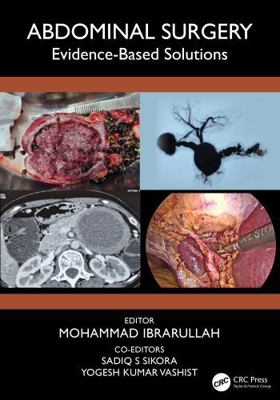 Abdominal Surgery: Evidence-Based Solutions 1041143613 Book Cover