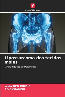 Lipossarcoma dos tecidos moles [Portuguese] 6209459633 Book Cover