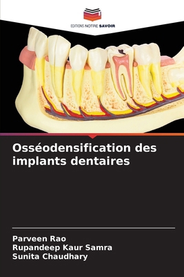 Osséodensification des implants dentaires [French] 6209390307 Book Cover