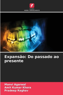Expansão: Do passado ao presente [Portuguese] 6630013913 Book Cover