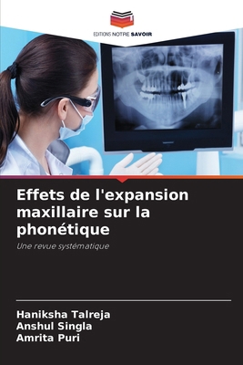 Effets de l'expansion maxillaire sur la phonétique [French] 6208161533 Book Cover