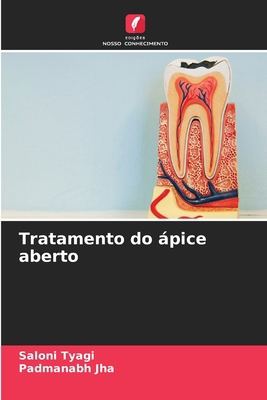Tratamento do ápice aberto [Portuguese] 6207673301 Book Cover