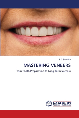 Mastering Veneers 620846272X Book Cover