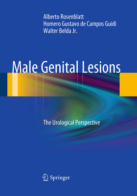 Male Genital Lesions: The Urological Perspective 3662507099 Book Cover