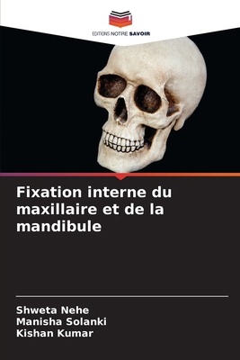 Fixation interne du maxillaire et de la mandibule [French] 6208867193 Book Cover