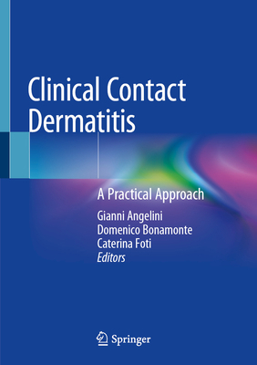 Clinical Contact Dermatitis: A Practical Approach 3030493318 Book Cover