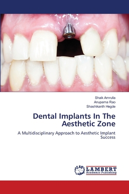 Dental Implants In The Aesthetic Zone 6208450136 Book Cover