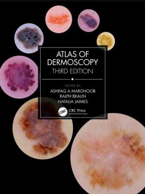 Atlas of Dermoscopy: Third Edition 1138595985 Book Cover