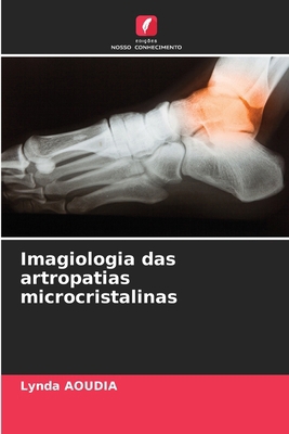 Imagiologia das artropatias microcristalinas [Portuguese] 6208087775 Book Cover