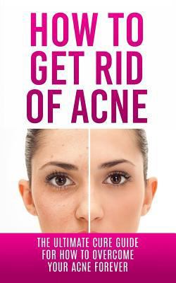 How to Get Rid of Acne: The Ultimate Cure Guide... 1507848714 Book Cover