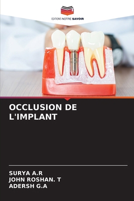 Occlusion de l'Implant [French] 6207931645 Book Cover