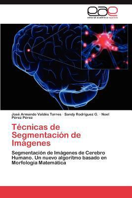 Tecnicas de Segmentacion de Imagenes [Spanish] 3847361538 Book Cover
