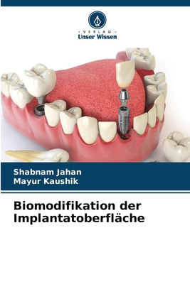 Biomodifikation der Implantatoberfläche [German] 6206869814 Book Cover