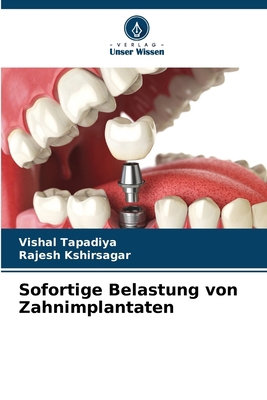 Sofortige Belastung von Zahnimplantaten [German] 6207660757 Book Cover