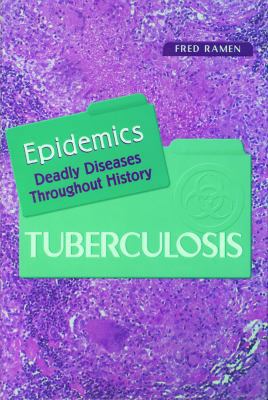Tuberculosis 0823933490 Book Cover