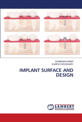 Implant Surface and Design 6207841697 Book Cover