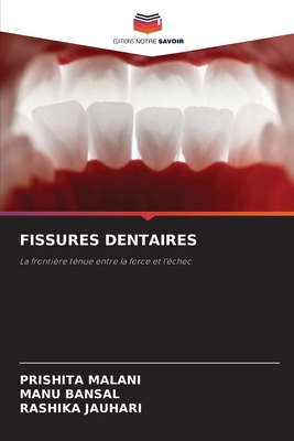 Fissures Dentaires [French] 6209106919 Book Cover