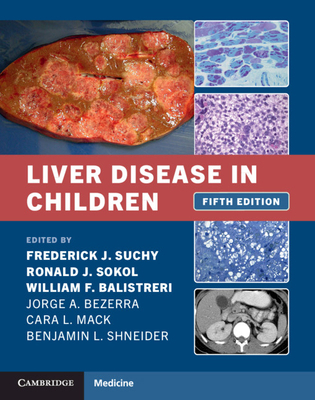 Liver Disease in Children 1108843514 Book Cover