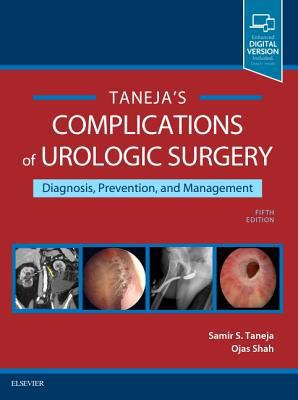 Complications of Urologic Surgery: Prevention a... 0323392423 Book Cover