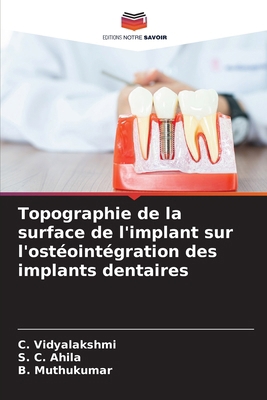 Topographie de la surface de l'implant sur l'os... [French] 6208651026 Book Cover