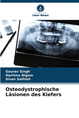 Osteodystrophische Läsionen des Kiefers [German] 6208285747 Book Cover