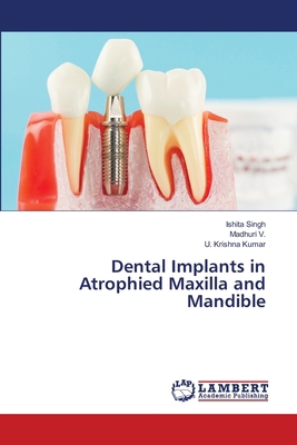 Dental Implants in Atrophied Maxilla and Mandible 6208437512 Book Cover