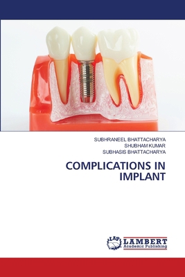 Complications in Implant 6208118476 Book Cover