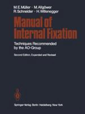 Manual of Internal Fixation: Techniques Recomme... 3642965075 Book Cover