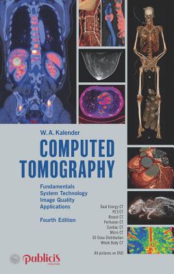 Computed Tomography: Fundamentals, System Techn... 3895784710 Book Cover