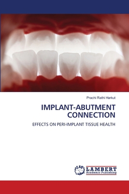 Implant-Abutment Connection 6208116805 Book Cover