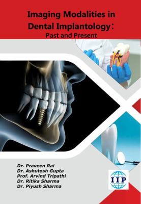 Imaging Modalities in Dental Implantology Past and Present
