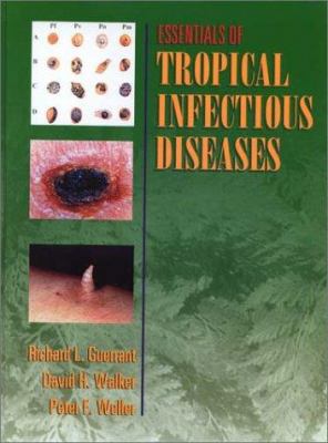 Essentials of Tropical Infectious Diseases 0443079099 Book Cover