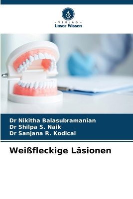 Weißfleckige Läsionen [German] 6208096154 Book Cover