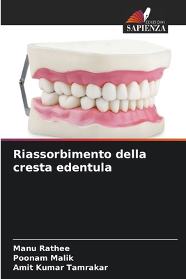 Riassorbimento della cresta edentula [Italian] 6209229549 Book Cover