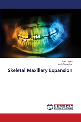 Skeletal Maxillary Expansion 6209317855 Book Cover