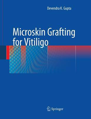 Microskin Grafting for Vitiligo 1447168798 Book Cover