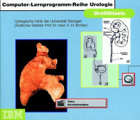 Urolithiasis [German] 3540147403 Book Cover