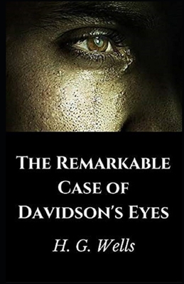 Paperback The Remarkable Case of Davidson's Eyes Illustrated Book