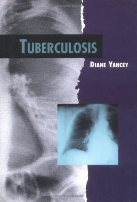 Tuberculosis 0761316248 Book Cover