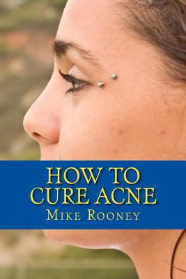 How To Cure Acne: What Is Acne And The Best Tre... 1482389029 Book Cover