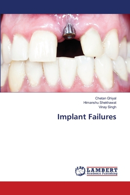 Implant Failures 3659925276 Book Cover