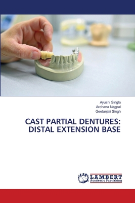Cast Partial Dentures: Distal Extension Base 6630113608 Book Cover