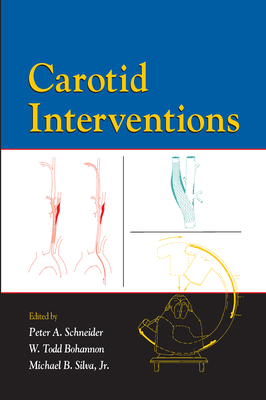 Carotid Interventions 082475932X Book Cover