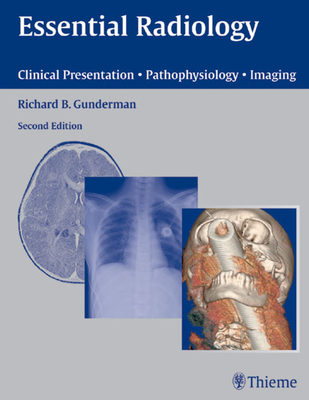 Essential Radiology: Clinical Presentation - Pa... 1588900827 Book Cover