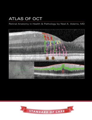 Atlas of OCT: Retinal Anatomy in Health & Patho... 1687062102 Book Cover