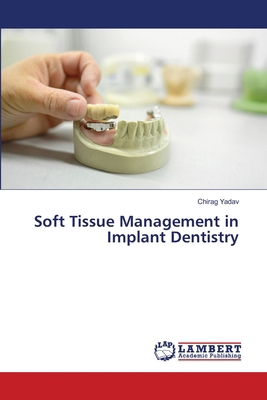 Soft Tissue Management in Implant Dentistry 6207639588 Book Cover