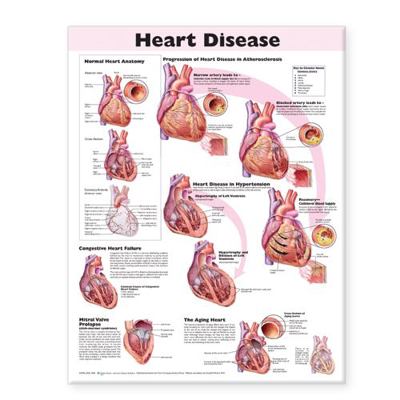 Heart Disease Anatomical Chart 0781773385 Book Cover