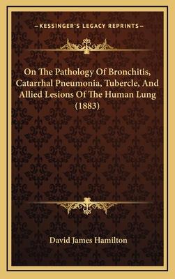 On the Pathology of Bronchitis, Catarrhal Pneum... 1165008386 Book Cover